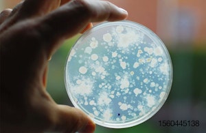 AGAR-bacteria-growing